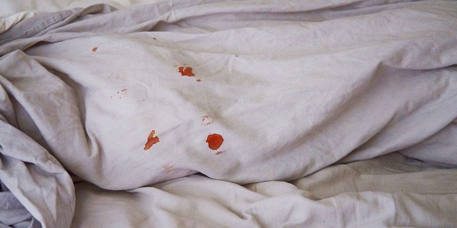 Step by step process of removing blood stains from fabric